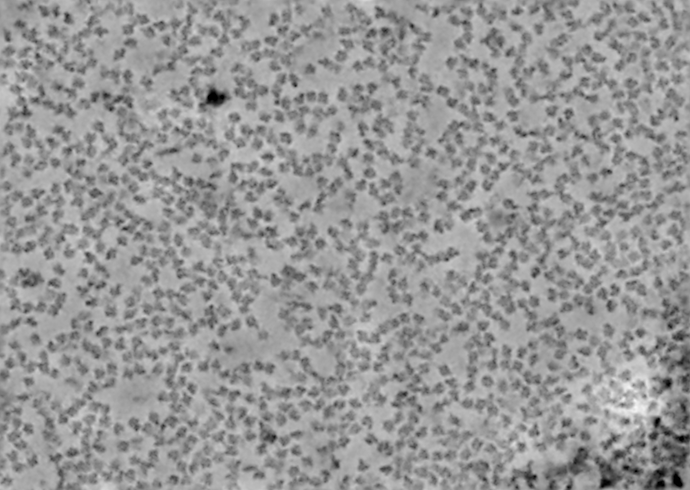 J13_denoised_output_micrograph