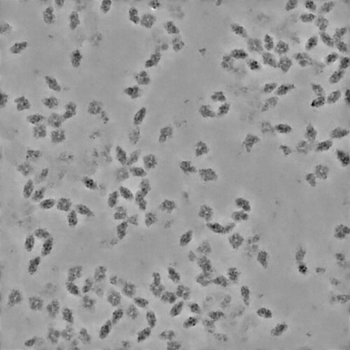 J5_denoised_output_micrograph