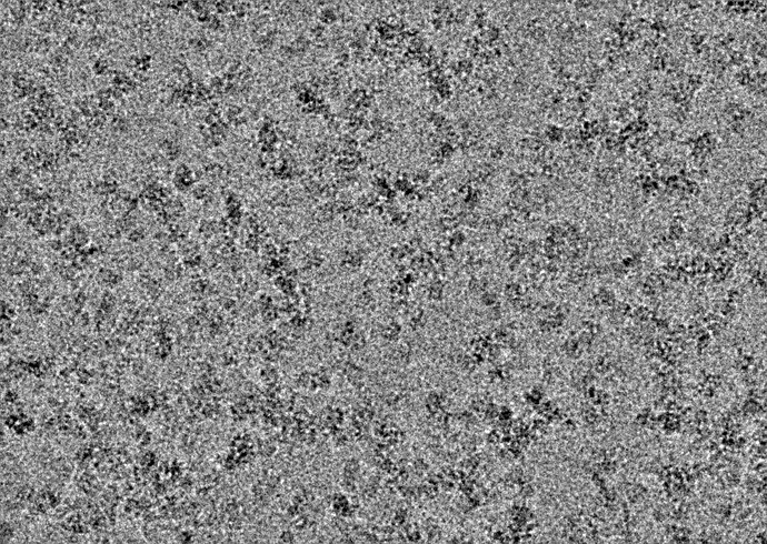 P5.J141.E1.micrograph